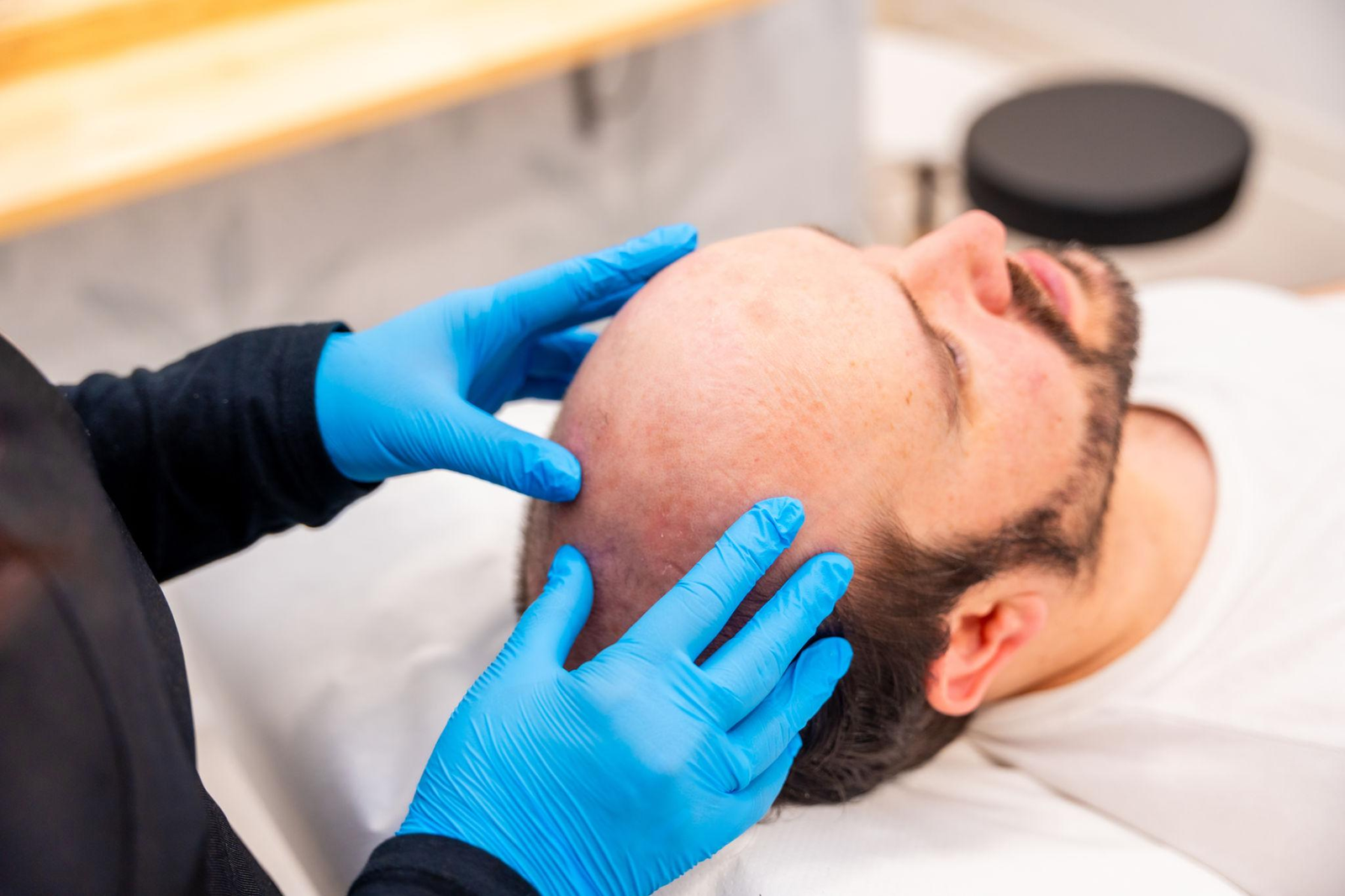 GFC hair treatment Lucknow Dr Disha